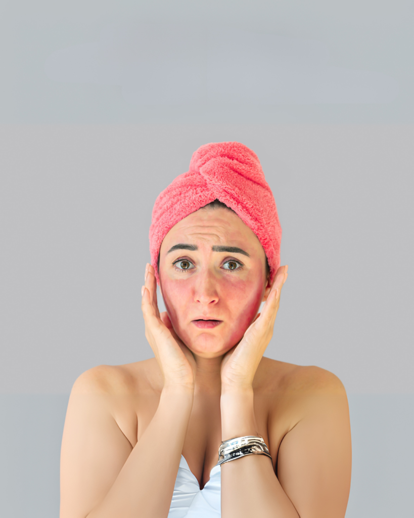 A lady with a towel on her head and a skin irritation on her face from using expired skincare products.