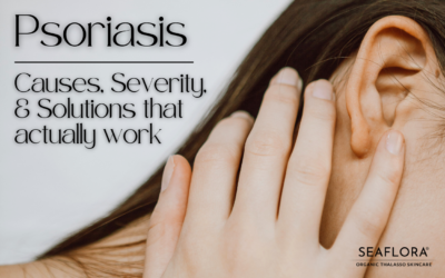 Psoriasis: What You Need to Know On Causes, Severity Score, & Natural Solutions That Work