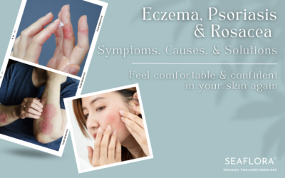 Eczema, Psoriasis, and Rosacea: Unlock Relief and Reclaim Your Confidence