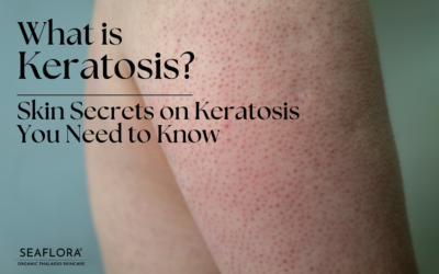 Keratosis Polaris