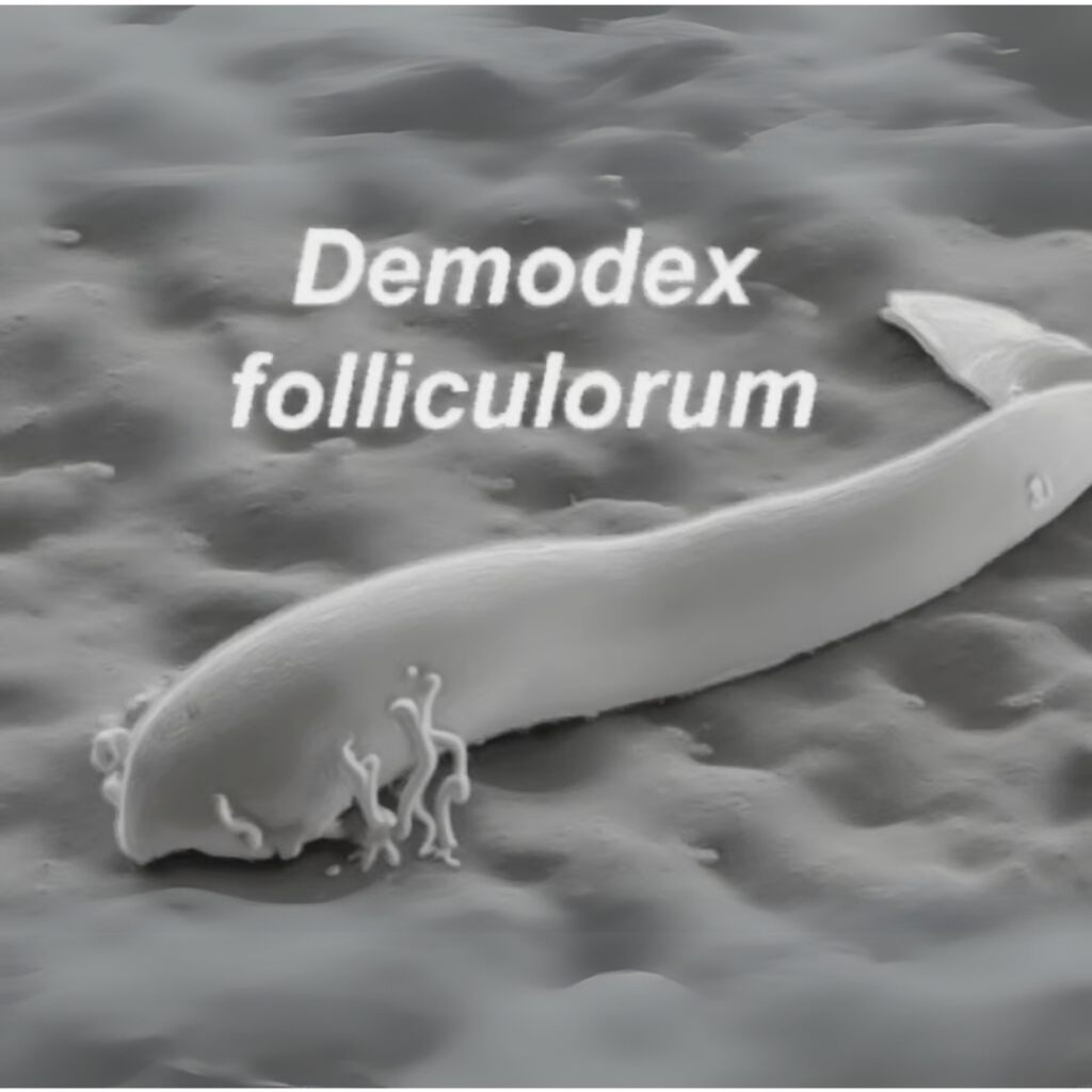 Demodex on the skin